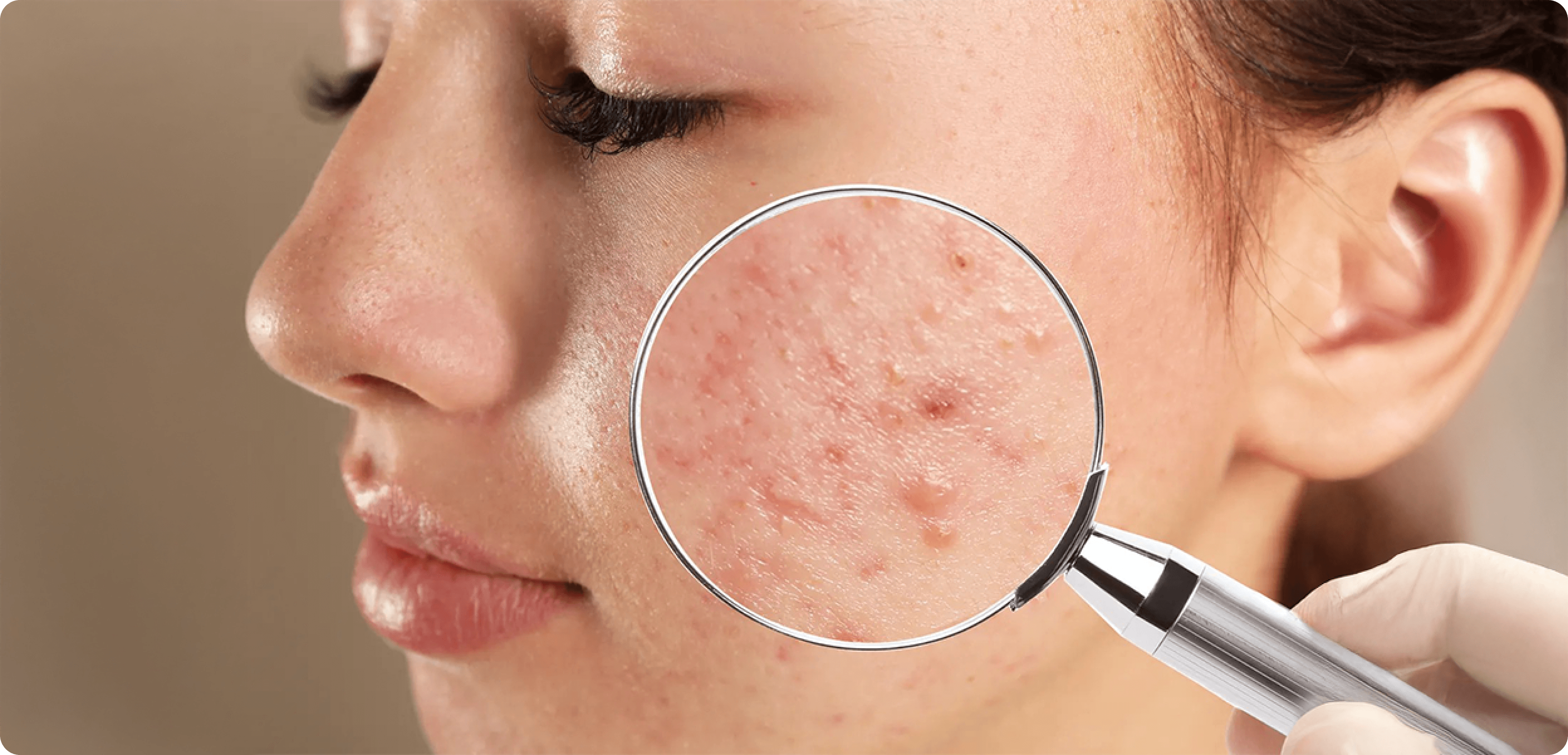 Lifestyle & Metabolism