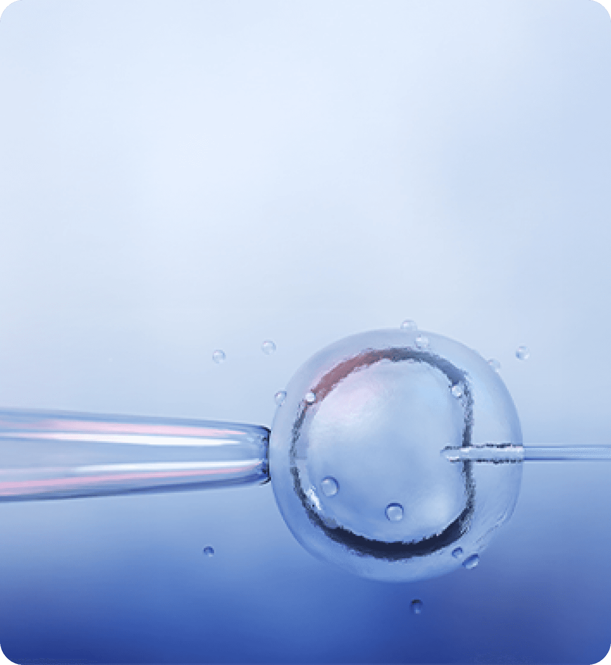In-Vitro Fertilization (IVF) 
