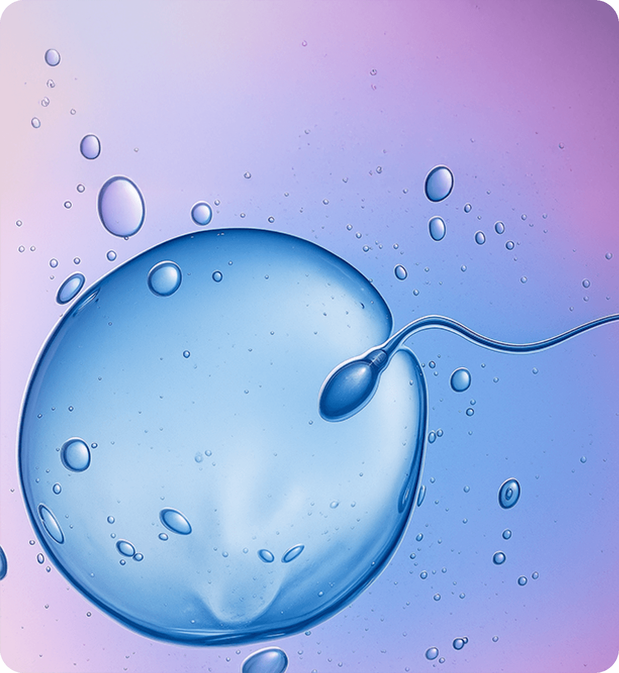 IVF-ICSI