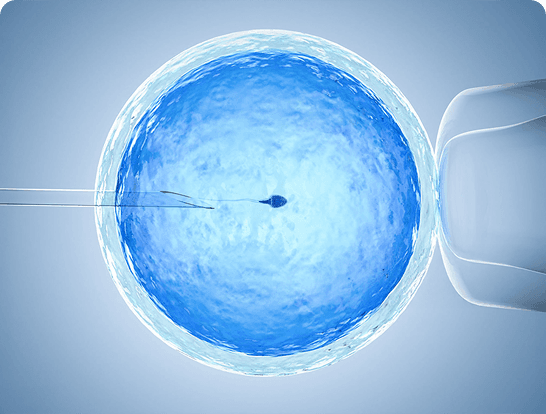 Egg Retrieval & Fertilization