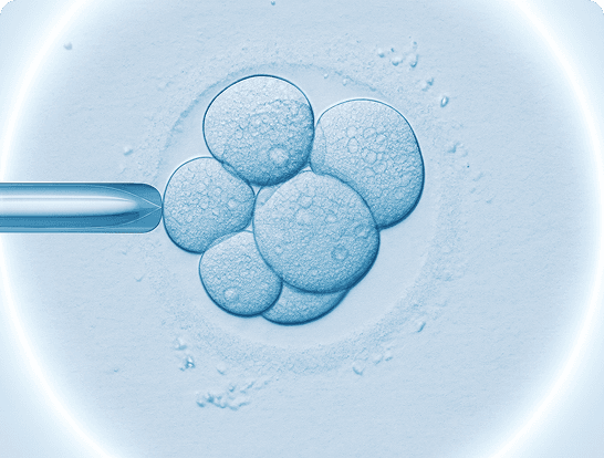Embryo transfer