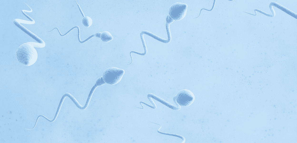 Obstructive Azoospermia