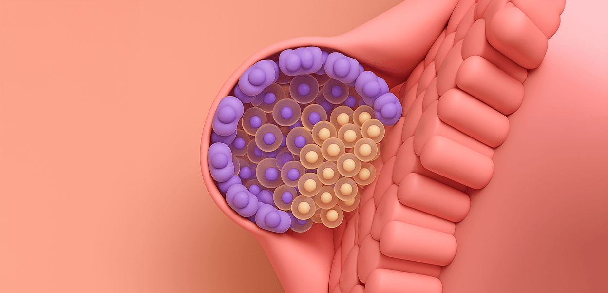 Genetic Predisposition Role