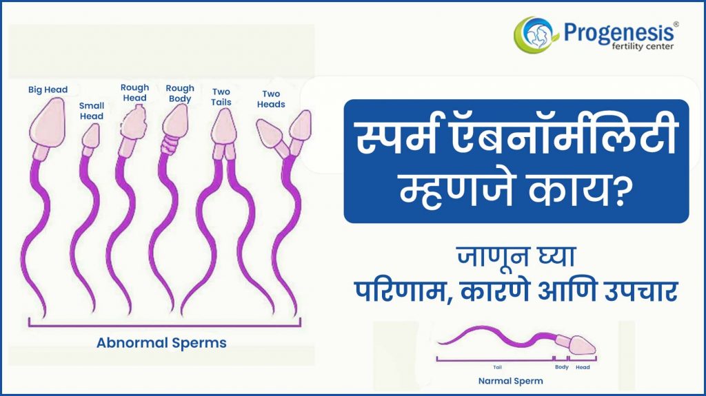 स्पर्म ऍबनॉर्मलिटी | Sperm Abnormality in marathi