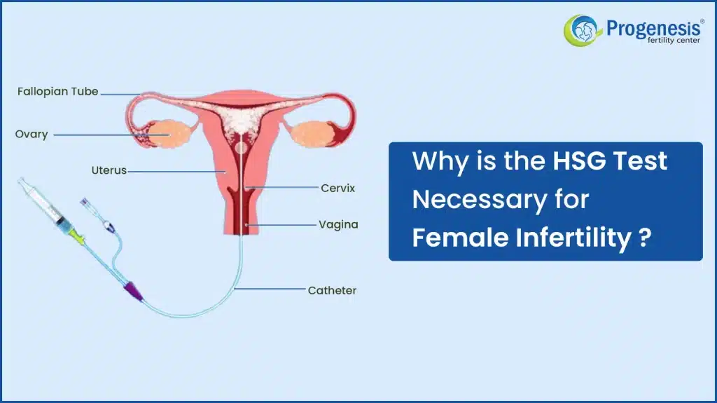 HSG Test for Female Infertility
