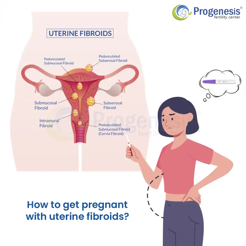 get pregnant with uterine fibroid