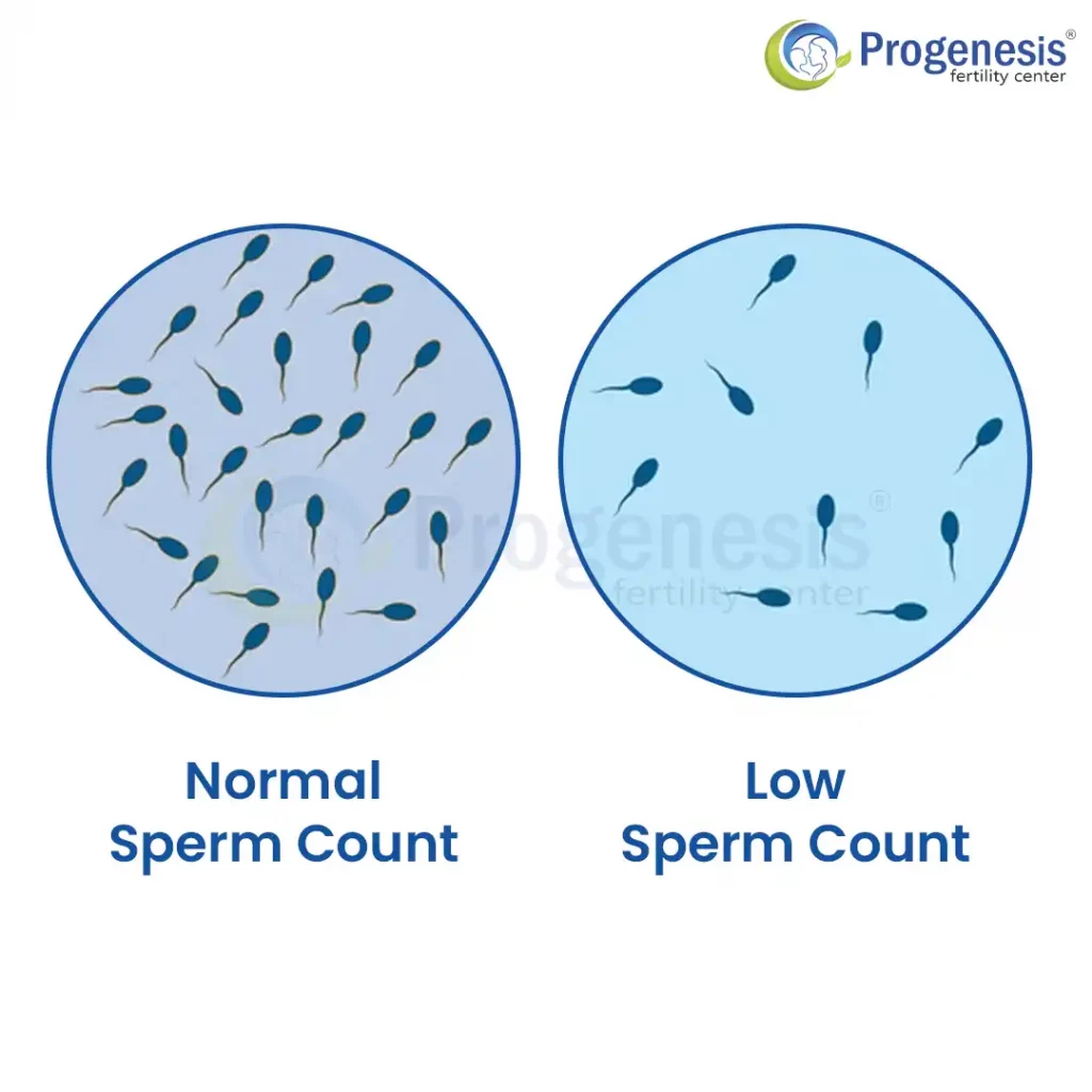 What is low sperm count