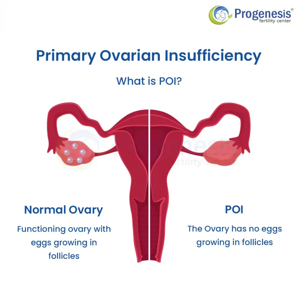 What is Primary Ovarian Insufficiency